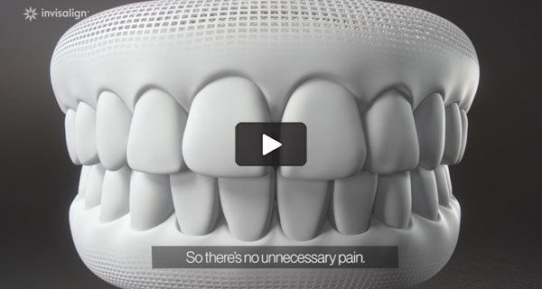 invisalign video