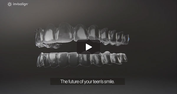 invisalign video