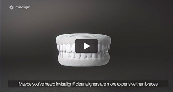 invisalign video